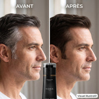 Tempes grises avant et après, visuel illustratif